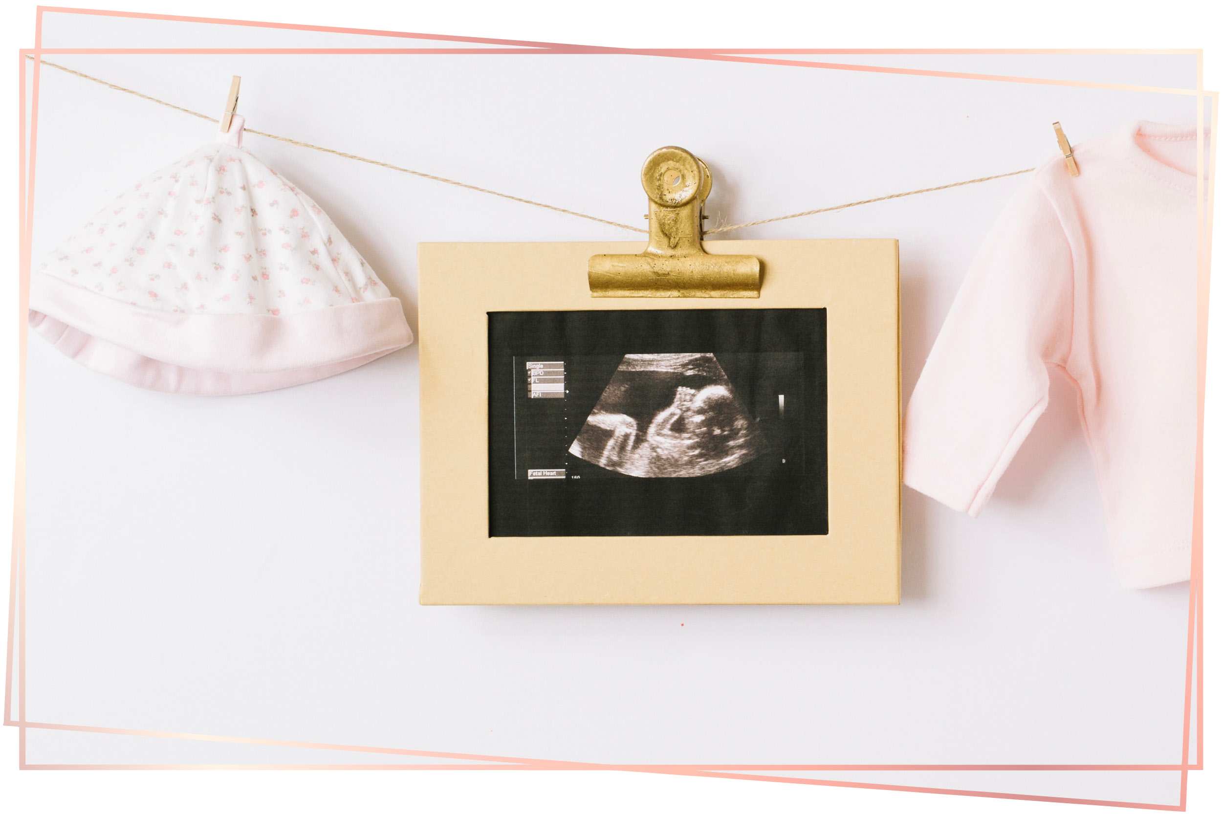 Schwangerschaft Hebammenpraxis Langerwehe2